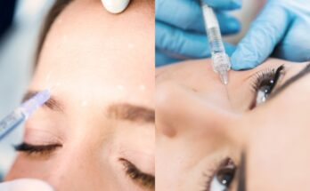 Eye Fillers